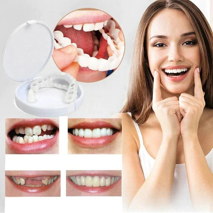 Snap-On Veneers für obere und untere Zähne für ein sofort natürliches Lächeln