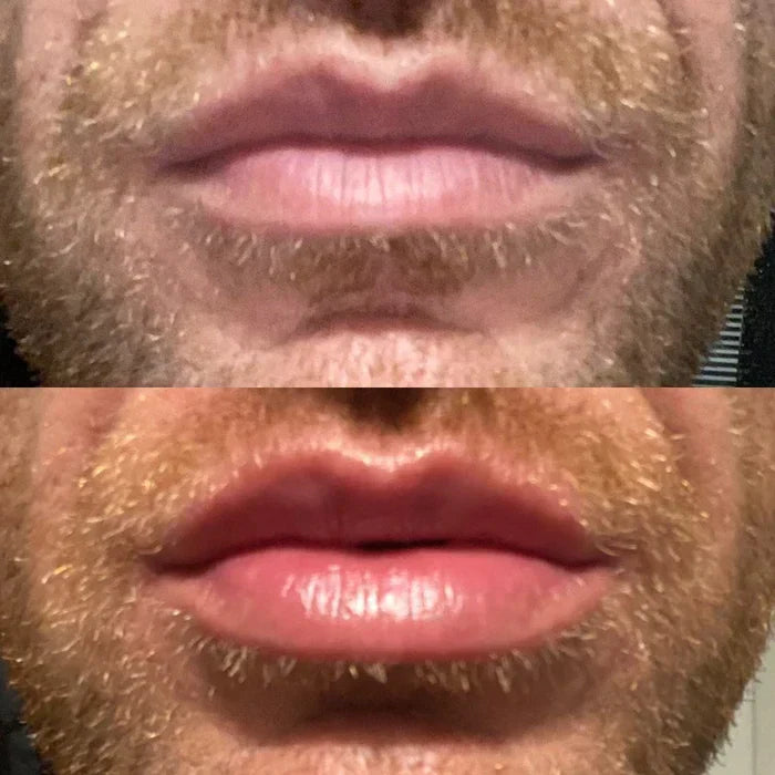 Schnelles Lippenfüllserum