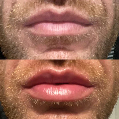 Schnelles Lippenfüllserum