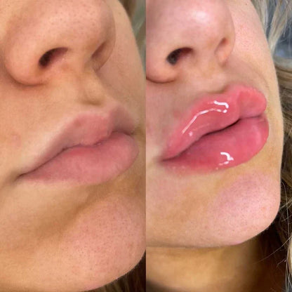 Schnelles Lippenfüllserum