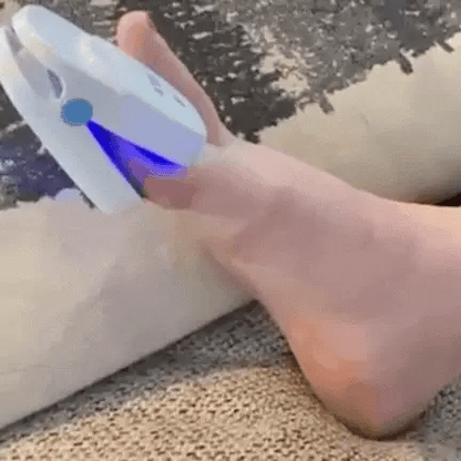 Lasergerät zur Behandlung von Fußnagelpilz für zu Hause