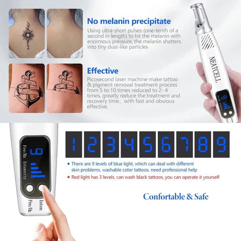 Laserpen zur Entfernung von Tattoos, Muttermalen und Sommersprossen