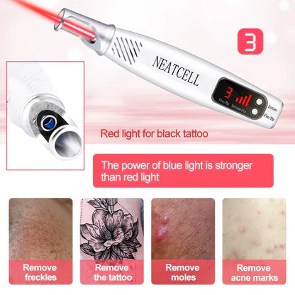 Laserpen zur Entfernung von Tattoos, Muttermalen und Sommersprossen