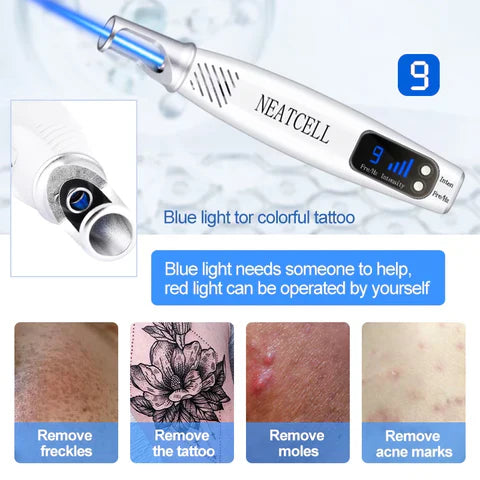 Laserpen zur Entfernung von Tattoos, Muttermalen und Sommersprossen