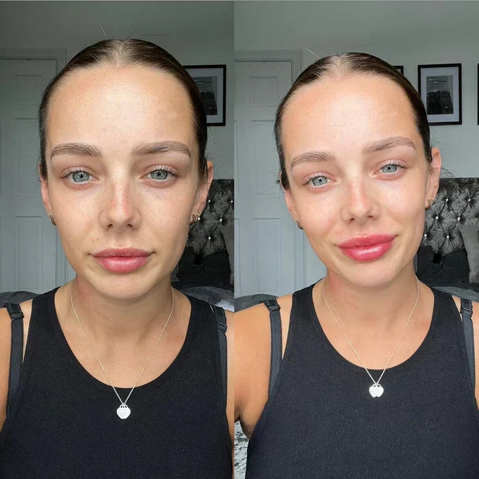 Schnelles Lippenfüllserum