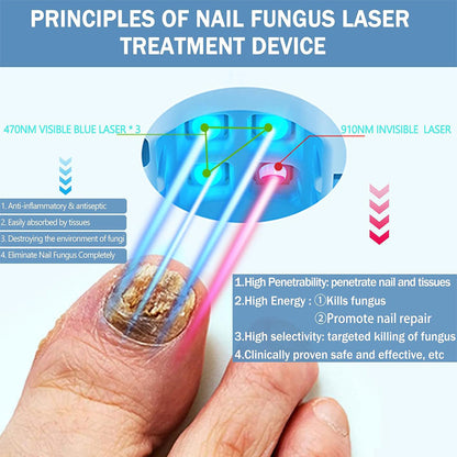 Lasergerät zur Behandlung von Fußnagelpilz für zu Hause